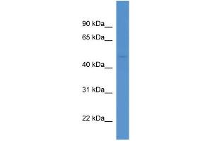 WB Suggested Anti-Aadacl1 Antibody Titration:  0. (NCEH1 Antikörper  (Middle Region))
