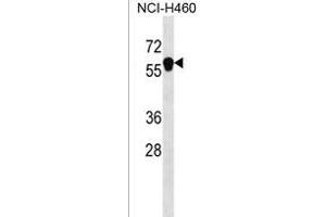 ANKDD1B Antibody (C-term) (ABIN1537327 and ABIN2850198) western blot analysis in NCI- cell line lysates (35 μg/lane). (ANKDD1B Antikörper  (C-Term))