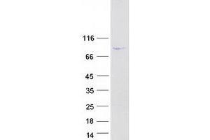 Dynein Regulatory Complex Subunit 1 (DRC1) protein (Myc-DYKDDDDK Tag)