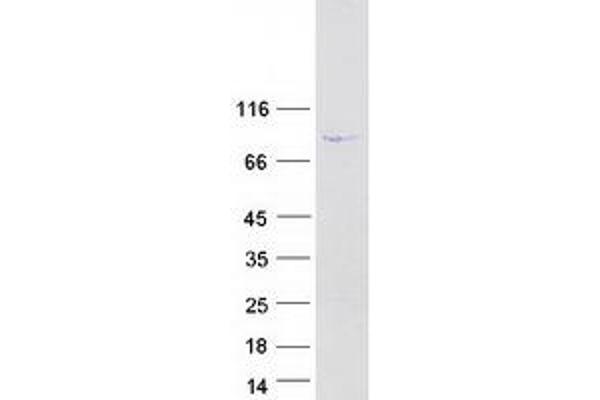 Dynein Regulatory Complex Subunit 1 (DRC1) protein (Myc-DYKDDDDK Tag)