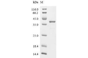 (Tris-Glycine gel) Discontinuous SDS-PAGE (reduced) with 5 % enrichment gel and 15 % separation gel.