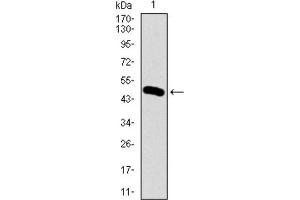 Western blot analysis using BMPR1A antibody against HEK293 (1) and BMPR1A (AA: 179-378) -hIgGFc transfected HEK293 (2) cell lysate. (BMPR1A Antikörper  (AA 179-378))