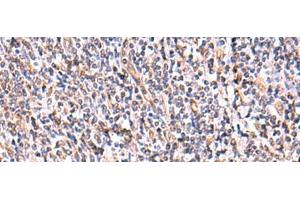 Immunohistochemistry of paraffin-embedded Human tonsil tissue using UXS1 Polyclonal Antibody at dilution of 1:60(x200) (UXS1 Antikörper)