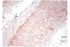 Immunohistochemistry using  polyclonal TNFa antibody showing staining of formalin/PFA-fixed paraffin-embedded sections of human artery tissue sections. (TNF alpha Antikörper)