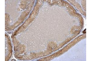 Immunohistochemistry (IHC) image for anti-Heat Shock 70kDa Protein 8 (HSPA8) (C-Term) antibody (ABIN2854950)