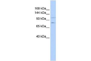 WB Suggested Anti-PTPRH Antibody Titration:  0. (PTPRH Antikörper  (Middle Region))