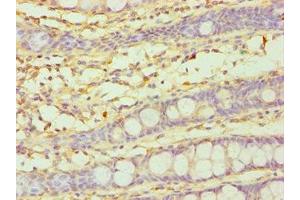 Immunohistochemistry of paraffin-embedded human colon tissue using ABIN7149265 at dilution of 1:100 (CYP3A5 Antikörper  (AA 233-502))