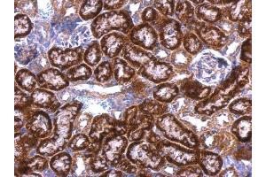 IHC-P Image GDI1 antibody detects GDI1 protein at cytosol on mouse kidney by immunohistochemical analysis. (GDI1 Antikörper)
