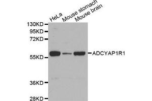 Western Blotting (WB) image for anti-Adenylate Cyclase Activating Polypeptide 1 (Pituitary) Receptor Type I (ADCYAP1R1) antibody (ABIN3023490) (ADCYAP1R1 Antikörper)