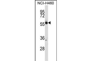 CR Antibody (N-term) (ABIN657682 and ABIN2846674) western blot analysis in NCI- cell line lysates (35 μg/lane).