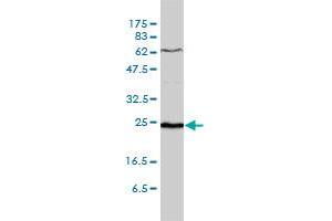 SDF2 monoclonal antibody (M01), clone 3G7-1D6 Western Blot analysis of SDF2 expression in WI-38 .