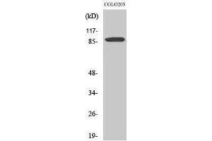 Western Blotting (WB) image for anti-Ewing Sarcoma Breakpoint Region 1 (EWSR1) (Internal Region) antibody (ABIN3175035) (EWSR1 Antikörper  (Internal Region))
