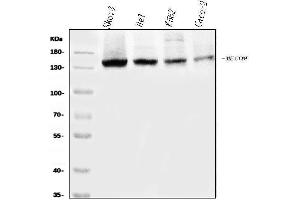 Western blot analysis of EVI1/MECOM using anti-EVI1/MECOM antibody (ABIN7599882).