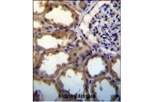 PDGFC antibody (N-term) (ABIN650654 and ABIN2837869) immunohistochemistry analysis in formalin fixed and paraffin embedded human kidney tissue followed by peroxidase conjugation of the secondary antibody and DAB staining.