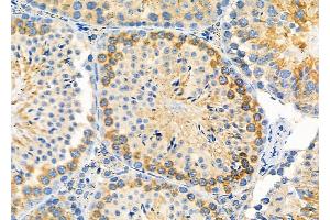 ABIN6264206 and ABIN6279656 at 1/100 staining Mouse testis tissue by IHC-P.