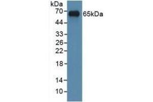 Detection of Recombinant MYC, Human using Polyclonal Antibody to V-Myc Myelocytomatosis Viral Oncogene Homolog (MYC) (LMYC Antikörper  (AA 184-454))