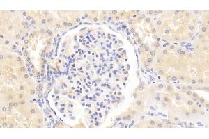 Detection of LAMa3 in Human Kidney Tissue using Monoclonal Antibody to Laminin Alpha 3 (LAMa3)