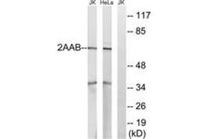 Western blot analysis of extracts from HeLa/Jurkat cells, using PPP2R1B Antibody.