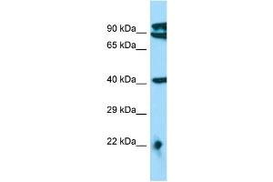 WB Suggested Anti-MTERFD3 Antibody Titration: 1. (MTERFD3 Antikörper  (N-Term))