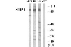 Western blot analysis of extracts from MCF-7 cells, 293 cells and Jurkat cells, using N4BP1 antibody. (N4BP1 Antikörper  (Internal Region))