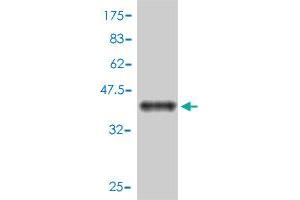 Western Blot detection against Immunogen (39. (SH2D1A Antikörper  (AA 1-128))