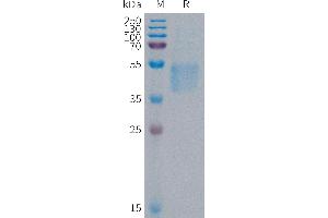Human F Protein, His Tag on SDS-PAGE under reducing condition.