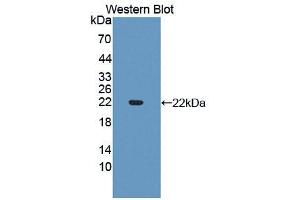 Western blot analysis of the recombinant protein. (SLIT3 Antikörper  (AA 1405-1512))