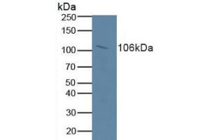 Detection of RB1 in Human Serum using Polyclonal Antibody to Retinoblastoma Protein 1 (RB1) (Retinoblastoma 1 Antikörper  (AA 639-778))