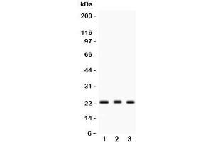 Western blot testing of MGMT antibody and human samples 1:  HeLa;  2: placenta;  3: Jurkat. (MGMT Antikörper  (AA 2-207))