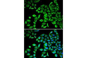 Immunofluorescence (IF) image for anti-C-Reactive Protein (CRP) (AA 1-224) antibody (ABIN3020716) (CRP Antikörper  (AA 1-224))