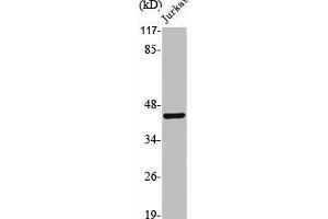 Western Blot analysis of Jurkat cells using PKR1 Polyclonal Antibody (Prokineticin Receptor 1 Antikörper  (N-Term))