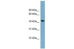 CDCA7L antibody used at 1 ug/ml to detect target protein. (CDCA7L Antikörper  (Middle Region))