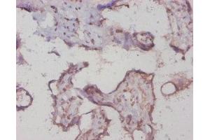 Immunohistochemistry of paraffin-embedded human placenta tissue using ABIN7154210 at dilution of 1:20 (PYGL Antikörper  (AA 2-846))