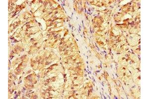 Immunohistochemistry of paraffin-embedded human adrenal gland tissue using ABIN7144308 at dilution of 1:100 (Anoctamin 4 Antikörper  (AA 1-200))