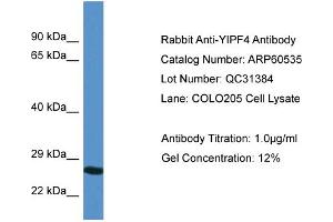 Western Blotting (WB) image for anti-Yip1 Domain Family, Member 4 (YIPF4) (N-Term) antibody (ABIN2788486)