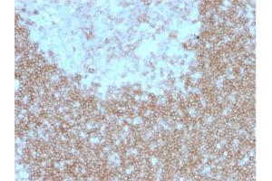 Immunohistochemistry (IHC) image for anti-Tumor Necrosis Factor Receptor Superfamily, Member 13C (TNFRSF13C) antibody (ABIN6939146)