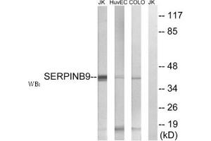 Western blot analysis of extracts from Jurkat cells, using SERPINB9 antibody. (SERPINB9 Antikörper  (Internal Region))
