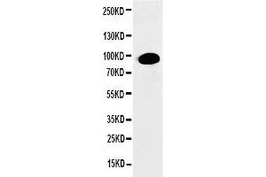 Anti-PKC alpha antibody, Western blottingWB: HELA Cell Lysate (PKC alpha Antikörper  (N-Term))