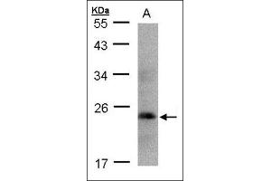 Sample( 30 µg whole cell lysate). (Growth Hormone 1 Antikörper  (Ser235))