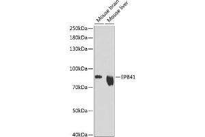 Western blot analysis of extracts of various cell lines, using EPB41 Antibody (ABIN6132258, ABIN6140197, ABIN6140198 and ABIN6216056) at 1:1000 dilution. (EPB41 Antikörper  (AA 210-500))