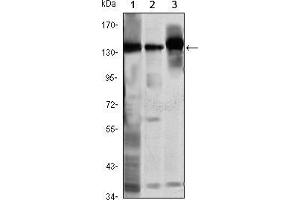 Western blot analysis using SMC1 mouse mAb against K562 (1), Jurkat (2) and A549 (3) cell lysate. (SMC1A Antikörper)