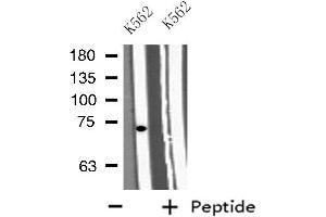 Western blot analysis of extracts from K562 cells, using GAB2 antibody. (GAB2 Antikörper  (C-Term))