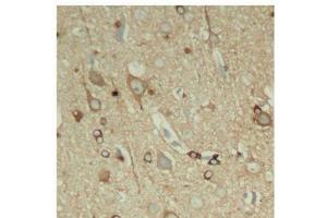 Immunohistochemistry of paraffin-embedded Rat hippocampal region tissue from a model with Alzheimer, using Phospho-Tau(S396) Polyclonal Antibody (tau Antikörper  (pSer396))