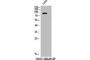 Western Blot analysis of LOVO+H2O2 cells using Phospho-Cortactin (Y421) Polyclonal Antibody (Cortactin Antikörper  (pTyr421))
