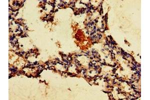 Immunohistochemistry of paraffin-embedded human lung tissue using ABIN7153347 at dilution of 1:100 (GPR4 Antikörper  (AA 285-362))