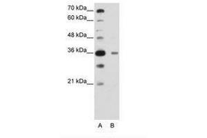 Image no. 2 for anti-DAZ Associated Protein 1 (DAZAP1) (C-Term) antibody (ABIN6736222) (DAZAP1 Antikörper  (C-Term))