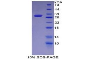 SDS-PAGE (SDS) image for KH Domain Containing, RNA Binding, Signal Transduction Associated 1 (KHDRBS1) (AA 156-381) protein (His tag) (ABIN1879681)