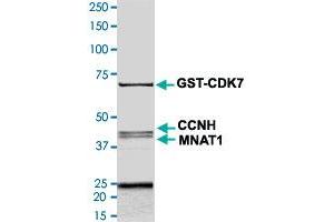 Image no. 1 for Cyclin-Dependent Kinase 7 (CDK7) (AA 1-346) (Active) protein (His-GST) (ABIN5569618)