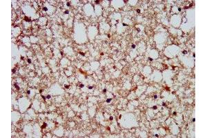 IHC image of ABIN7169777 diluted at 1:300 and staining in paraffin-embedded human brain tissue performed on a Leica BondTM system. (SLAIN1 Antikörper  (AA 43-136))