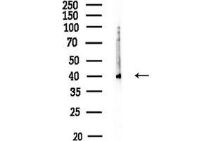 anti-Cathepsin K (CTSK) (N-Term) antibody